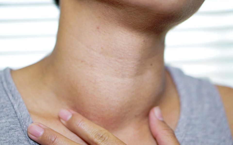 Thyroid Problems Hyperthyroidism